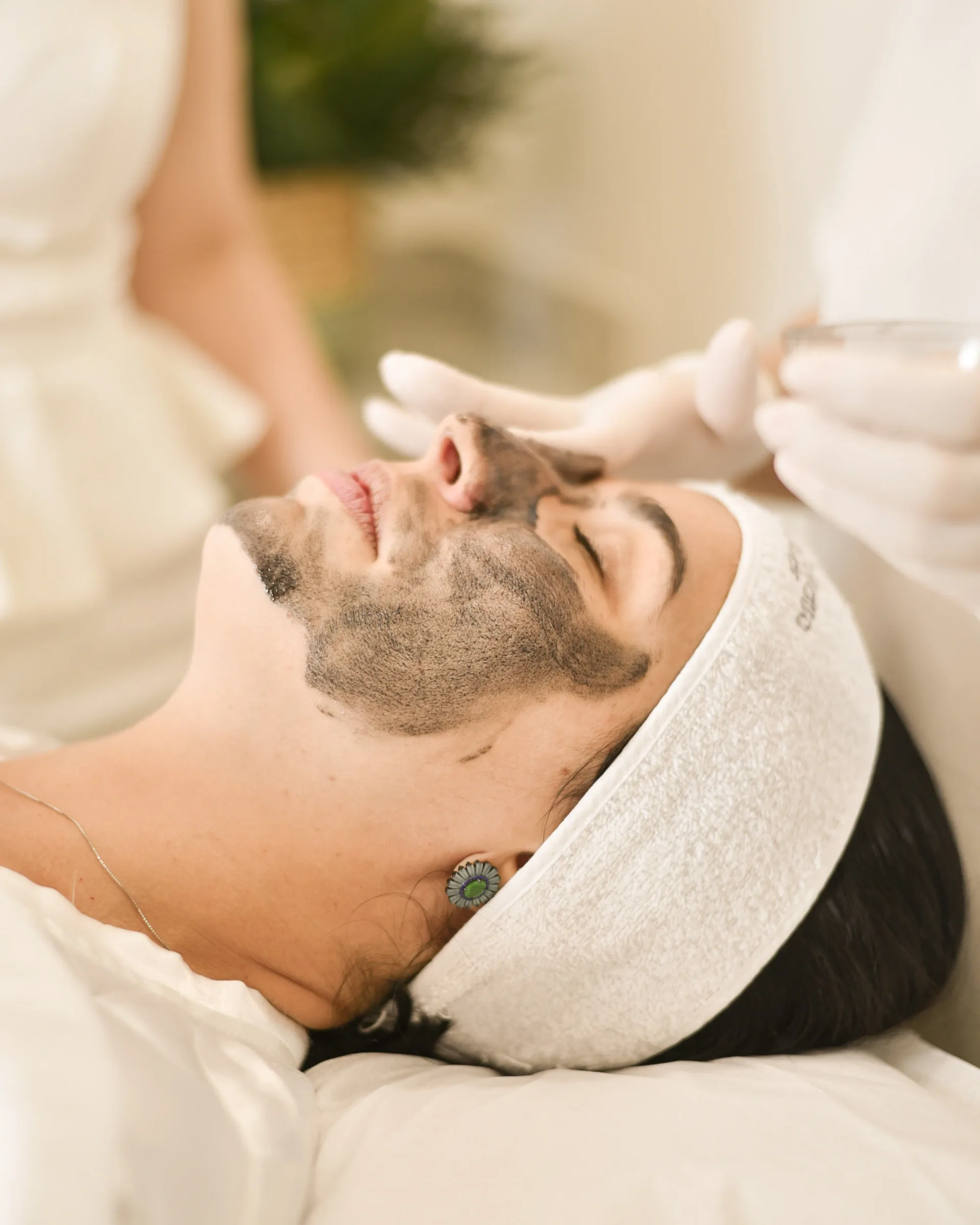 Tratamento para Manchas e Melasma - Manchas e melasma exigem diagnóstico correto e controle contínuo. Faça uma avaliação dermatológica em Uberlândia e conheça tratamentos individualizados.
